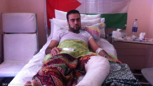 مصاب فلسطيني يتلقي العلاج في أحد المستشفيات المصرية 